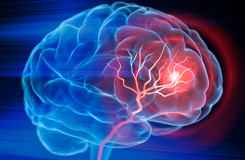 Science helps stroke survivor speak after nearly two decades