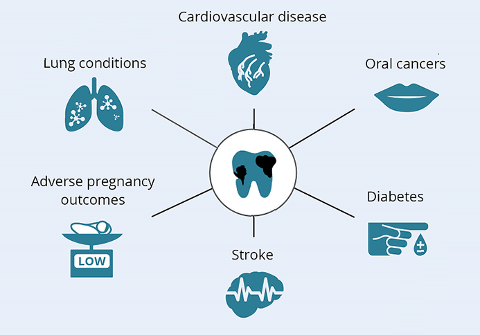 Consequences of poor oral health